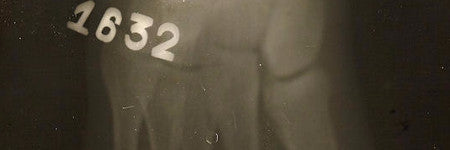 Ernest Hemingway's war x-rays to sell at Bonhams